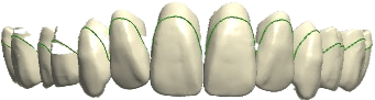 DELICATE teeth shape