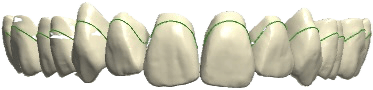 INDIVIDUAL teeth shape
