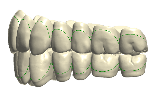 Regular(>2mm) teeth shape