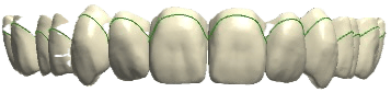 UNIVERSAL teeth shape